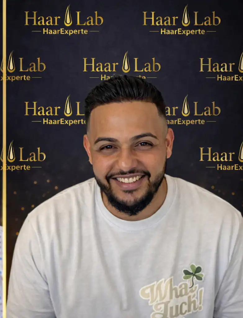 Haartransplantation Mannheim nachher